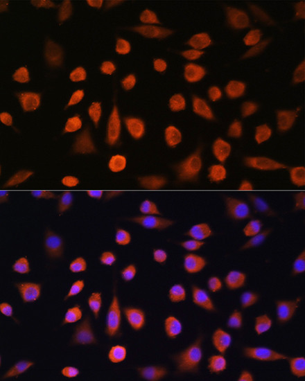EDEM2 Antibody in Immunocytochemistry (ICC/IF)