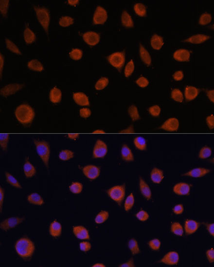 ZCCHC3 Antibody in Immunocytochemistry (ICC/IF)
