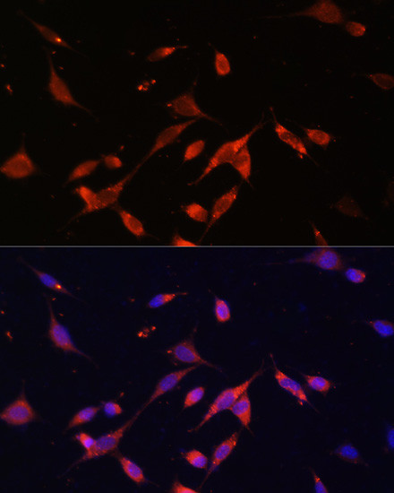 PIK3R2 Antibody in Immunocytochemistry (ICC/IF)