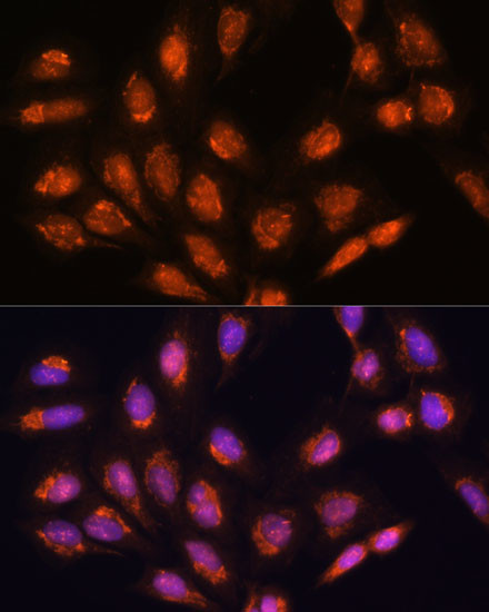 TIMM44 Antibody in Immunocytochemistry (ICC/IF)