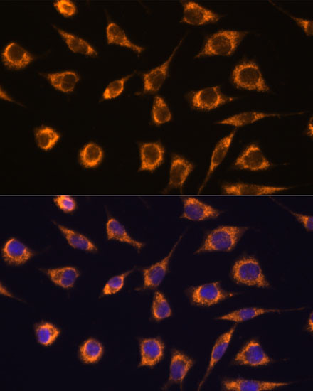 GSTA3 Antibody in Immunocytochemistry (ICC/IF)