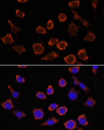 RPL35 Antibody in Immunocytochemistry (ICC/IF)