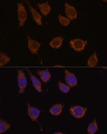 Carbonic Anhydrase VB Antibody in Immunocytochemistry (ICC/IF)