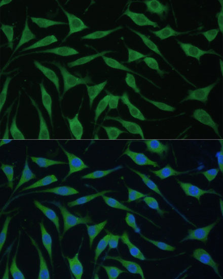 FAM127B Antibody in Immunocytochemistry (ICC/IF)
