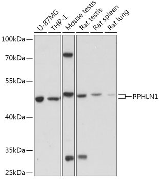 PPHLN1 Antibody in Western Blot (WB)