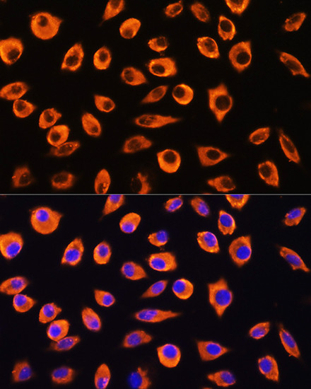 PCDHB4 Antibody in Immunocytochemistry (ICC/IF)