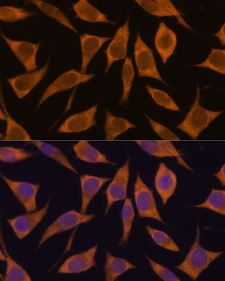 MRPL34 Antibody in Immunocytochemistry (ICC/IF)