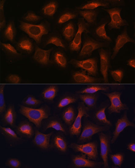 ARFGAP2 Antibody in Immunocytochemistry (ICC/IF)