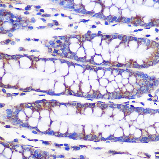 NEK9 Antibody in Immunohistochemistry (Paraffin) (IHC (P))