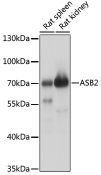 ASB2 Antibody in Western Blot (WB)