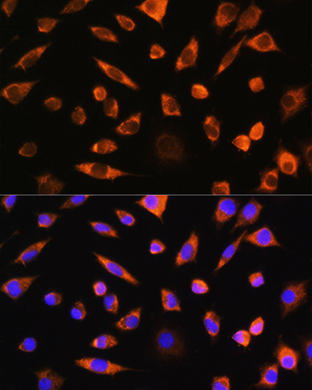 PEBP4 Antibody in Immunocytochemistry (ICC/IF)