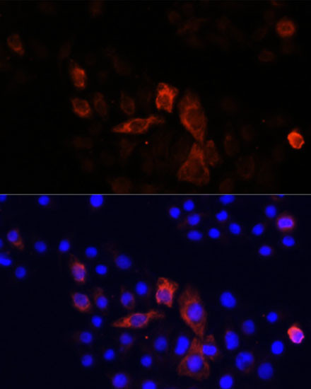 MT-ND2 Antibody in Immunocytochemistry (ICC/IF)