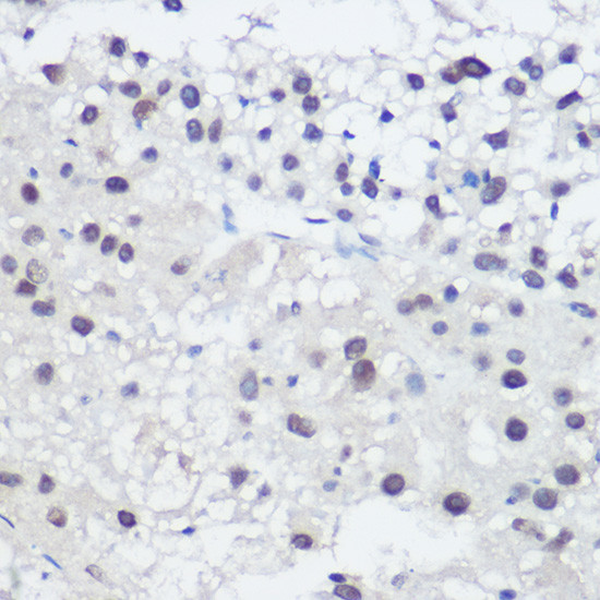 GADD45A Antibody in Immunohistochemistry (Paraffin) (IHC (P))