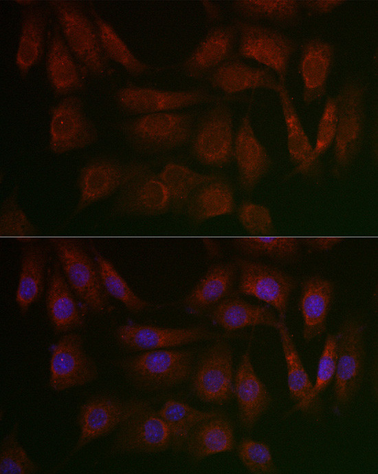 PERK Antibody in Immunocytochemistry (ICC/IF)