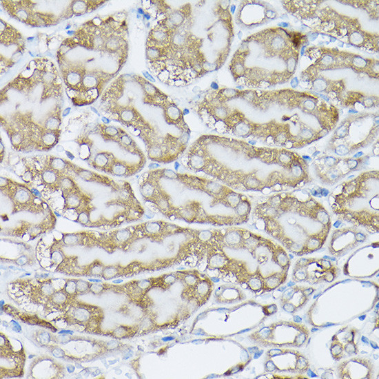 p130Cas Antibody in Immunohistochemistry (Paraffin) (IHC (P))
