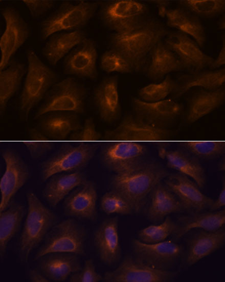 GPR22 Antibody in Immunocytochemistry (ICC/IF)