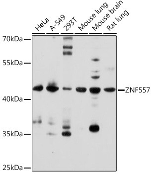 ZNF557 Antibody in Western Blot (WB)