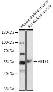 BPOZ Antibody in Western Blot (WB)