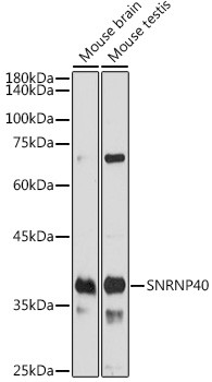 SNRNP40 Antibody in Western Blot (WB)