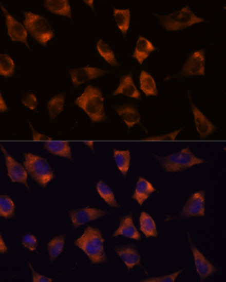 Connexin 50 Antibody in Immunocytochemistry (ICC/IF)