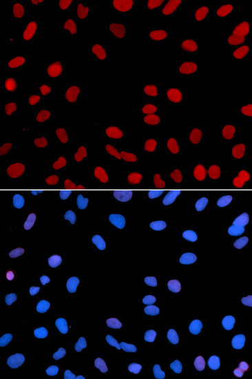 IFI16 Antibody in Immunocytochemistry (ICC/IF)