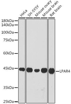 LPAR4 Antibody in Western Blot (WB)