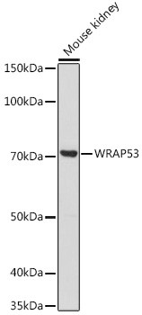 WRAP53 Antibody in Western Blot (WB)