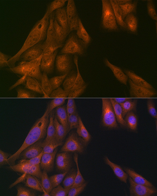 USP11 Antibody in Immunocytochemistry (ICC/IF)