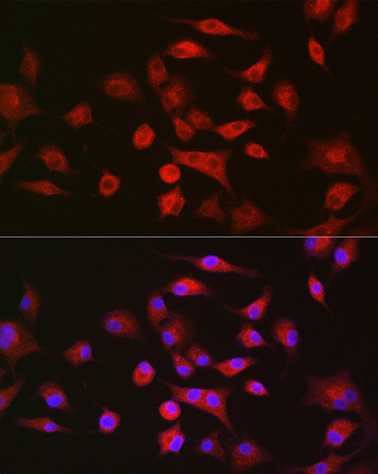 LLGL1 Antibody in Immunocytochemistry (ICC/IF)