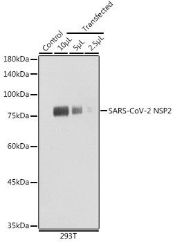 SARS-CoV-2 NSP2 Antibody in Western Blot (WB)