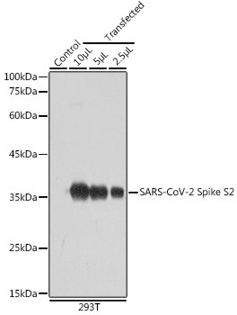SARS-CoV-2 Spike Protein S2 Antibody in Western Blot (WB)