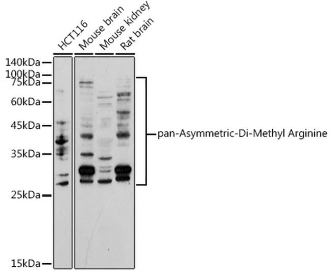 Asymmetric Di-Methyl Arginine Antibody in Western Blot (WB)