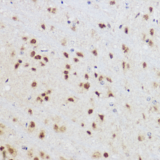 KLF12 Antibody in Immunohistochemistry (Paraffin) (IHC (P))