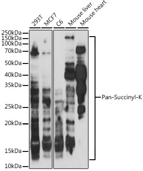 Succinylated Lysine Antibody in Western Blot (WB)