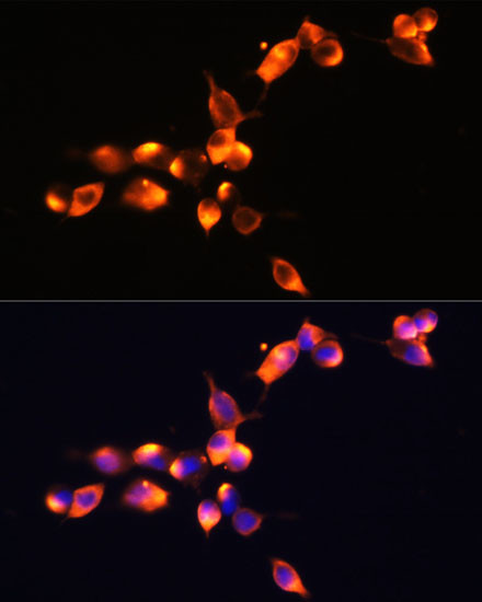 PSA Antibody in Immunocytochemistry (ICC/IF)