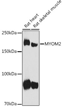 MYOM2 Antibody in Western Blot (WB)
