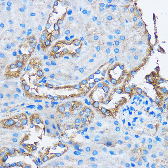CAPZA2 Antibody in Immunohistochemistry (Paraffin) (IHC (P))