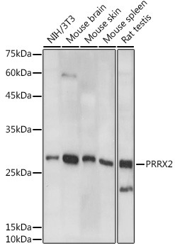 PRRX2 Antibody in Western Blot (WB)