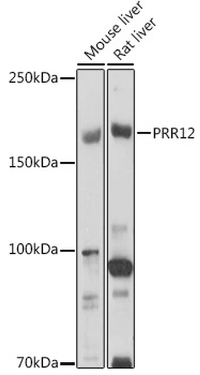 PRR12 Polyclonal Antibody (PA5120753)