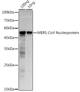 MERS Coronavirus NP Antibody in Western Blot (WB)