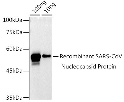 SARS-CoV-2 Nucleocapsid Antibody in Western Blot (WB)