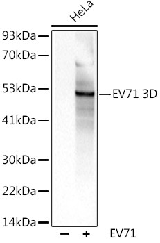 Enterovirus 71 3D Antibody in Western Blot (WB)