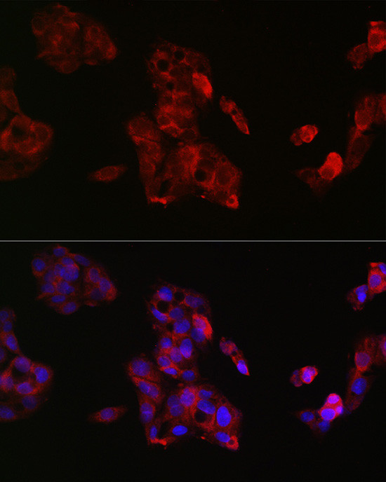 IGF2 Antibody in Immunocytochemistry (ICC/IF)