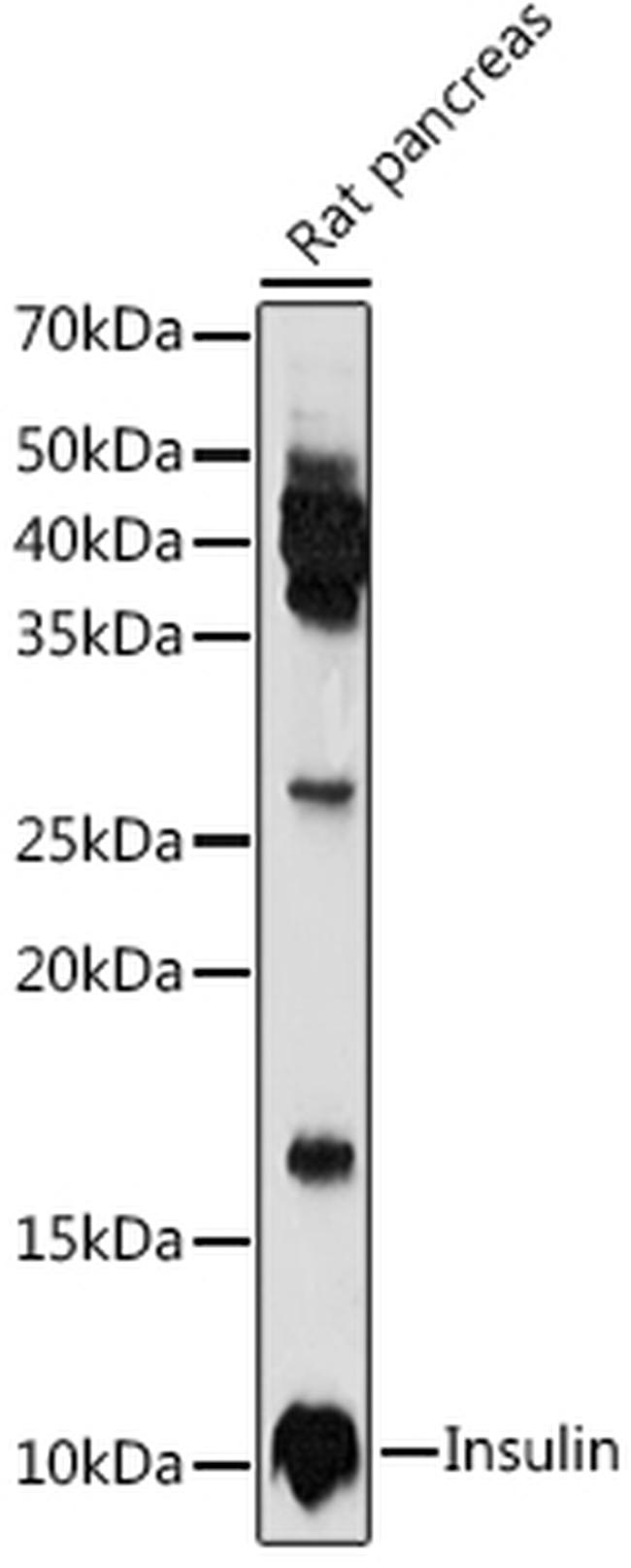Insulin Antibody (PA5120784)