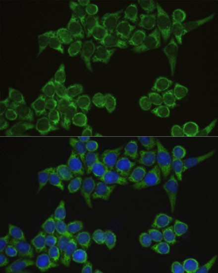 IRF3 Antibody in Immunocytochemistry (ICC/IF)
