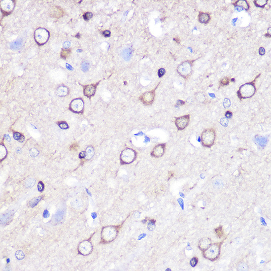 Stathmin 1 Antibody in Immunohistochemistry (Paraffin) (IHC (P))