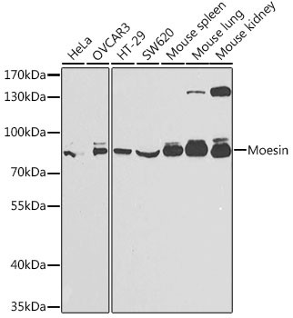 Moesin Antibody in Western Blot (WB)
