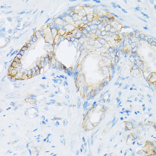 MRP4 Antibody in Immunohistochemistry (Paraffin) (IHC (P))