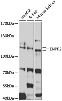 ENPP2 Antibody in Western Blot (WB)