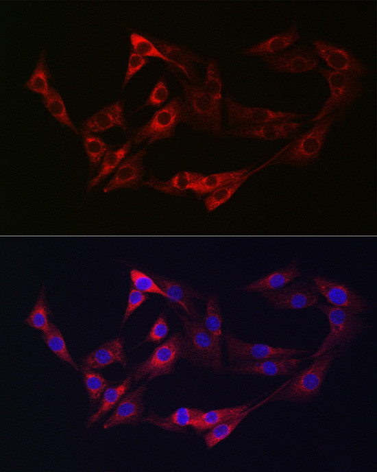 Neuropilin 2 Antibody in Immunocytochemistry (ICC/IF)